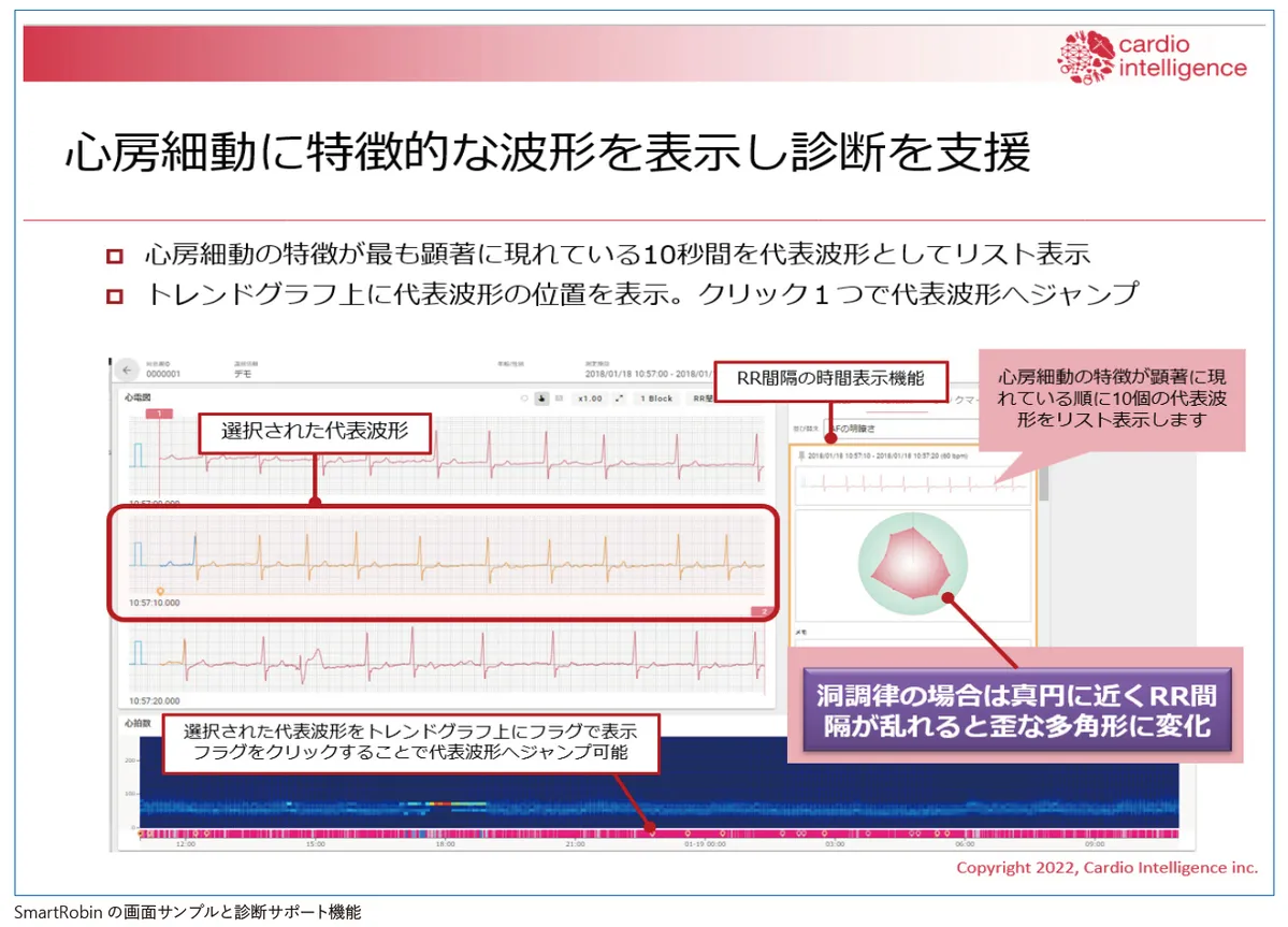 「SmartRobin」による診断例